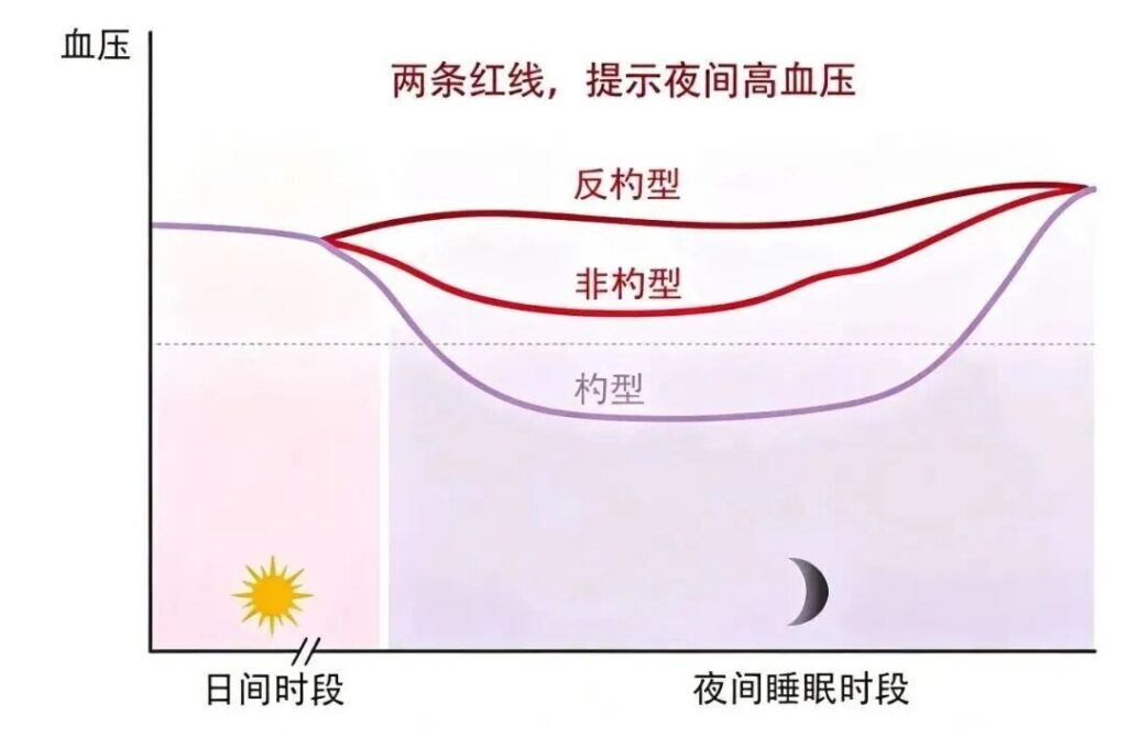 日夜间血压变化